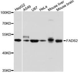 ABclonal Technology FADS2 Polyclonal Antibody, 100UL, Validated in:WB,