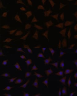 ABclonal Technology CDKN2A Polyclonal Antibody,100UL,Validated in: WB,