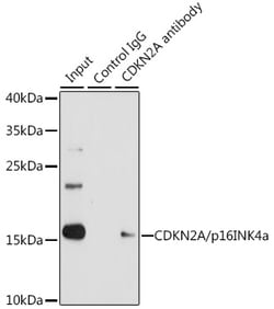 ABclonal Technology CDKN2A Polyclonal Antibody,100UL,Validated in: WB,