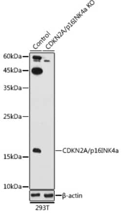 ABclonal Technology CDKN2A Polyclonal Antibody,100UL,Validated in: WB,