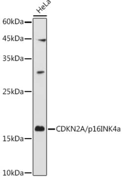 ABclonal Technology CDKN2A Polyclonal Antibody,100UL,Validated in: WB,