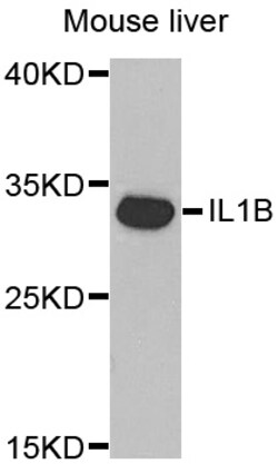 ABclonal Technology IL1B Polyclonal Antibody, 100UL, Validated in:WB, IF,