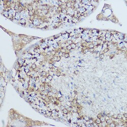 ABclonal Technology MT-CO2 Polyclonal Antibody,100UL,Validated in: WB,IF,