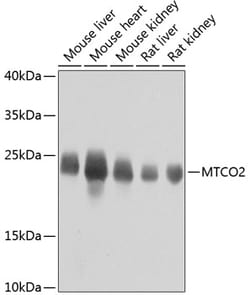ABclonal Technology MT-CO2 Polyclonal Antibody,100UL,Validated in: WB,IF,