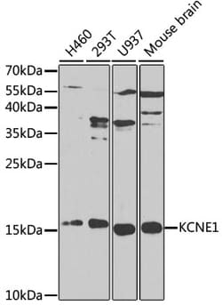 ABclonal Technology KCNE1 Polyclonal Antibody, 100UL, Validated in:WB,