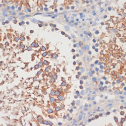 ABclonal Technology CDC42 Polyclonal Antibody, 100UL, Validated in:WB,IHC,