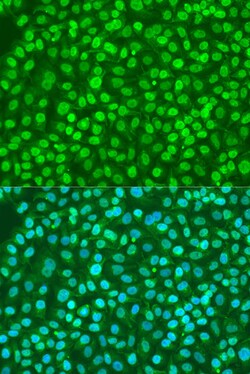 ABclonal Technology BDNF Polyclonal Antibody, 100UL, Validated in:WB, IHC,