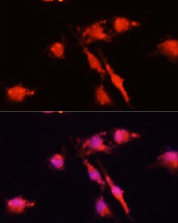ABclonal Technology BDNF Polyclonal Antibody, 100UL, Validated in:WB, IHC,