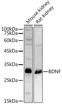 ABclonal Technology BDNF Polyclonal Antibody, 100UL, Validated in:WB, IHC,