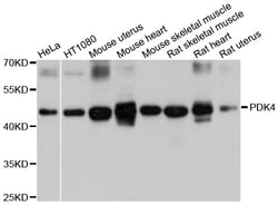 ABclonal Technology PDK4 Polyclonal Antibody, 100UL, Validated in:WB, Quantity: