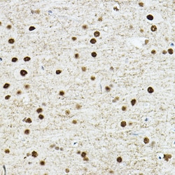 ABclonal Technology TEAD1 Polyclonal Antibody,100UL,Validated in: WB, IHC,