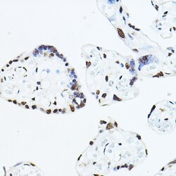 ABclonal Technology TEAD1 Polyclonal Antibody,100UL,Validated in: WB, IHC,