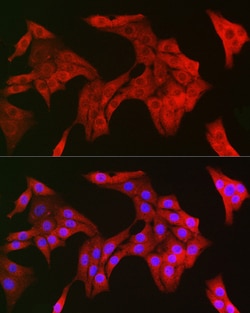 ABclonal Technology TRIM21 Polyclonal Antibody,100UL,Validated in: WB,IHC,IF,