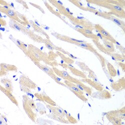 ABclonal Technology TRIM21 Polyclonal Antibody,100UL,Validated in: WB,IHC,IF,