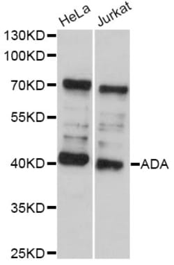 ABclonal Technology ADA Polyclonal Antibody, 100UL, Validated in:WB, Quantity: