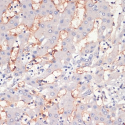 ABclonal Technology CD36 Polyclonal Antibody,100UL,Validated in: WB,IF,