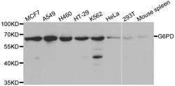 ABclonal Technology G6PD Polyclonal Antibody, 100UL, Validated in:WB, Quantity: