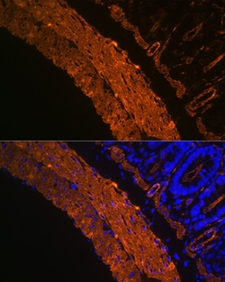 ABclonal Technology -Smooth Muscle Actin (ACTA2) Rabbit mAb 100 L, Quantity: