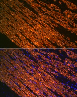 ABclonal Technology -Smooth Muscle Actin (ACTA2) Rabbit mAb 100 L, Quantity: