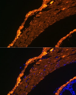 ABclonal Technology -Smooth Muscle Actin (ACTA2) Rabbit mAb 100 L, Quantity: