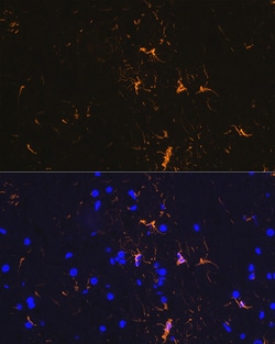 ABclonal Technology GFAP Rabbit mAb 100 L, Quantity: Each of 1