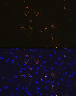 ABclonal Technology GFAP Rabbit mAb 100 L, Quantity: Each of 1