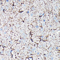 ABclonal Technology GFAP Rabbit mAb 100 L, Quantity: Each of 1