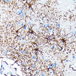 ABclonal Technology GFAP Rabbit mAb 100 L, Quantity: Each of 1