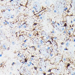 ABclonal Technology GFAP Rabbit mAb 100 L, Quantity: Each of 1