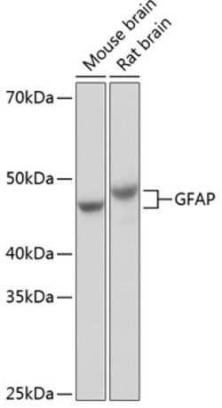 ABclonal Technology GFAP Rabbit mAb 100 L, Quantity: Each of 1