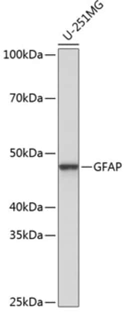ABclonal Technology GFAP Rabbit mAb 100 L, Quantity: Each of 1