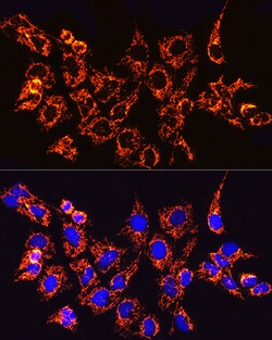 ABclonal Technology TOM20 Rabbit mAb 100 L, Quantity: Each of 1