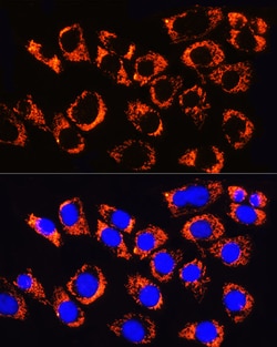 ABclonal Technology TOM20 Rabbit mAb 100 L, Quantity: Each of 1