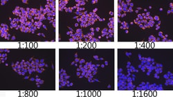 ABclonal Technology TOM20 Rabbit mAb 100 L, Quantity: Each of 1