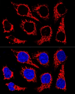 ABclonal Technology TOM20 Rabbit mAb 100 L, Quantity: Each of 1