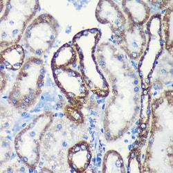 ABclonal Technology TOM20 Rabbit mAb 100 L, Quantity: Each of 1