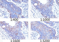 ABclonal Technology TOM20 Rabbit mAb 100 L, Quantity: Each of 1