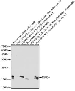 ABclonal Technology TOM20 Rabbit mAb 100 L, Quantity: Each of 1