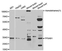ABclonal Technology TPSAB1 Polyclonal Antibody, 100UL, Validated in:WB,