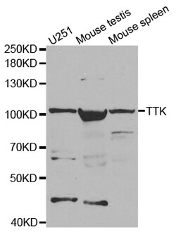 ABclonal Technology TTK Polyclonal Antibody, 100UL, Validated in:WB, IHC,