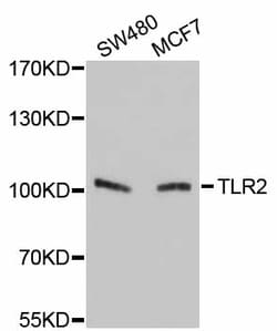 ABclonal Technology TLR2 Polyclonal Antibody, 100UL, Validated in:WB, Quantity: