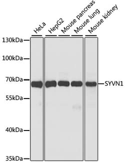 ABclonal Technology SYVN1 Polyclonal Antibody, 100UL, Validated in:WB,