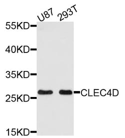 ABclonal Technology CLEC4D Polyclonal Antibody, 100UL, Validated in:WB,