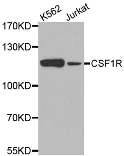 ABclonal Technology CSF1R Polyclonal Antibody, 100UL, Validated in:WB,