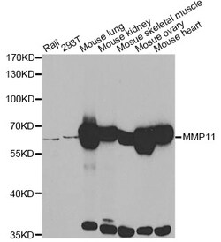 ABclonal Technology MMP11 Polyclonal Antibody, 100UL, Validated in:WB,