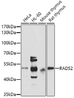 ABclonal Technology RAD52 Polyclonal Antibody, 100UL, Validated in:WB,