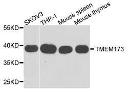 ABclonal Technology TMEM173 Polyclonal Antibody, 100UL, Validated in:WB,