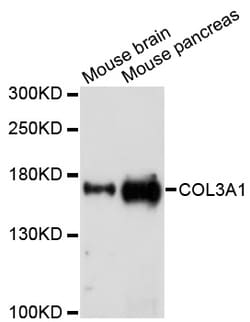 ABclonal Technology COL3A1 Polyclonal Antibody, 100UL, Validated in:WB,