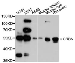 ABclonal Technology CRBN Polyclonal Antibody, 100UL, Validated in:WB, Quantity: