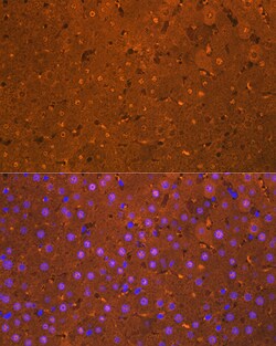 ABclonal Technology Arginase 1 (ARG1) Rabbit mAb 100 L, Quantity: Each